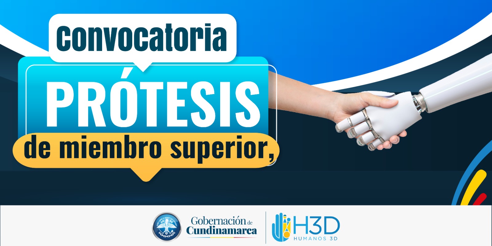 Cundinamarca abre inscripciones para entrega gratuita de prótesis de miembro superior a personas amputadas

